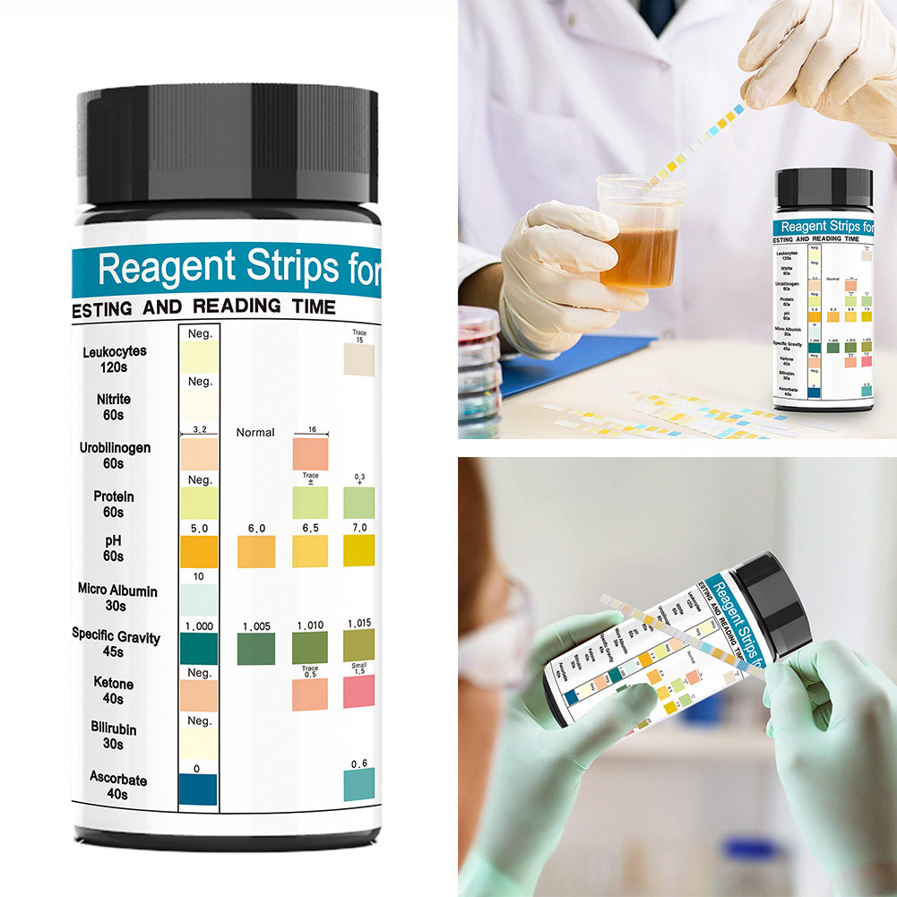 100 Strips Urine Test Strip 10 - Urinalysis Reagent Strip recensie en prijs