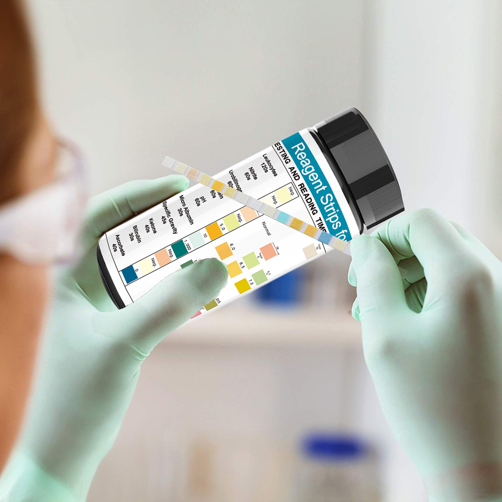 100 Strips Urine Test Strip 10 - Urinalysis Reagent Strip recensie en prijs