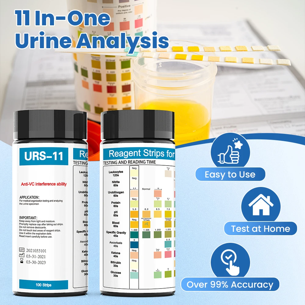Veterinary Human 10/11/12/14 P - Urinalysis Reagent Strip recensie en prijs